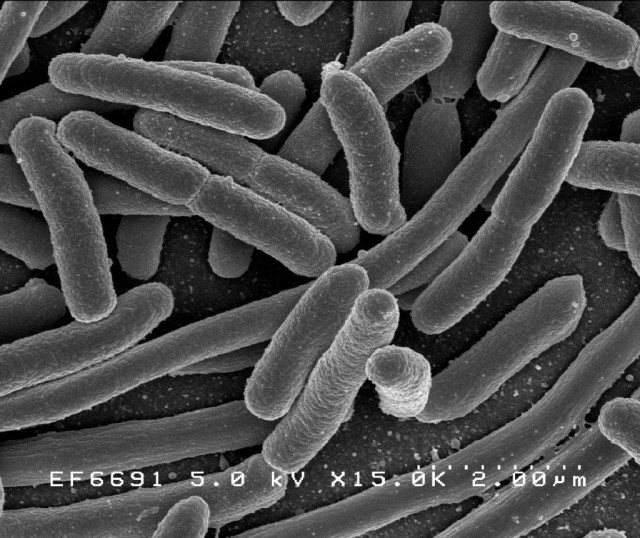 Escherichia coli, один з видів бактерій, які є у кишківнику 